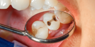 Cesmed-medica-odontoiatria-conservativa